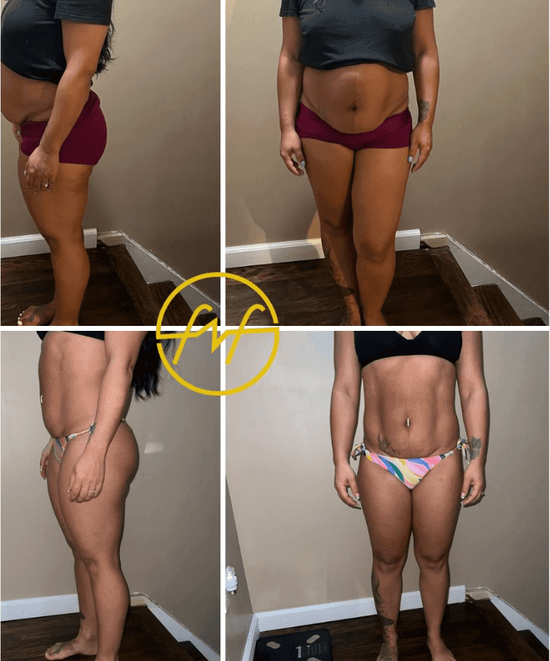 melissa-before-after