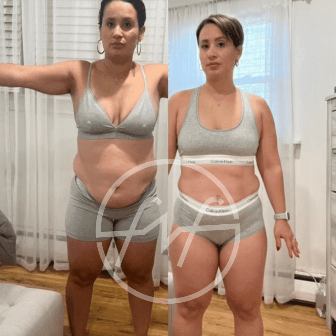before-after
